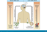 The Connection Between Sleep and Immune Health Enhanced The Connection Between Sleep and Immune Health Enhanced